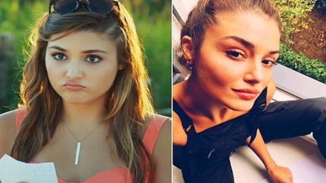 İşte estetikli ünlülerin listesi! Listeyi görünce 'yok artık onda da mı var?' diyeceksiniz 9